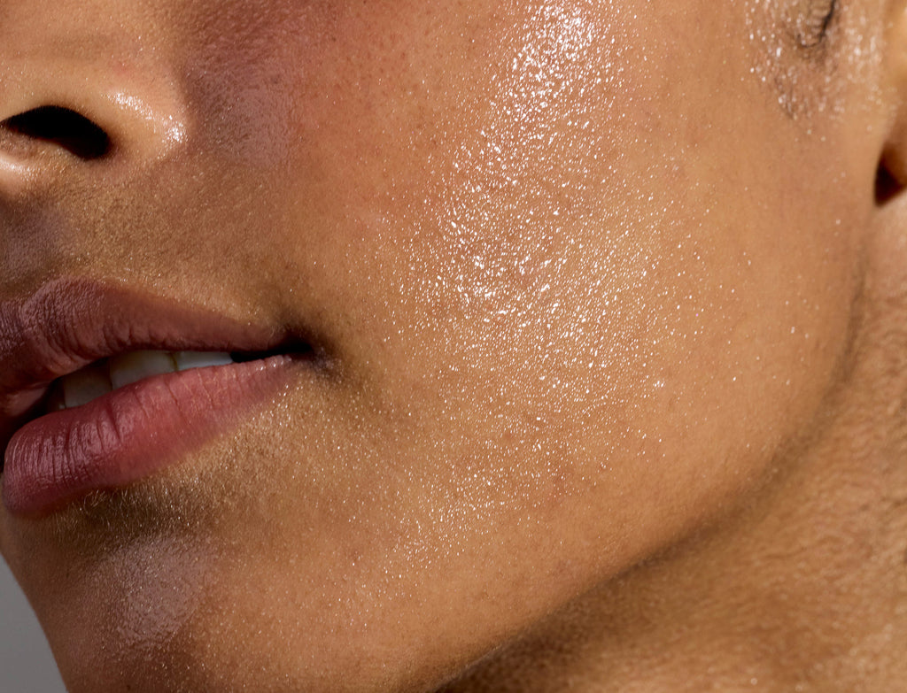 Dehydrated Skin vs. Dry Skin: Why Your Moisturizer Isn't Enough