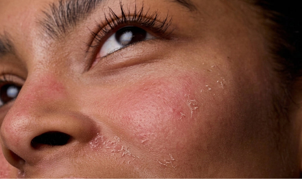 Retinol Is the Gold Standard — So Why Does It Destroy Your Skin the First Week?
