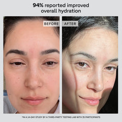Before and after comparison of a woman's face with improved overall hydration, shown in a study by a third-party testing lab.
