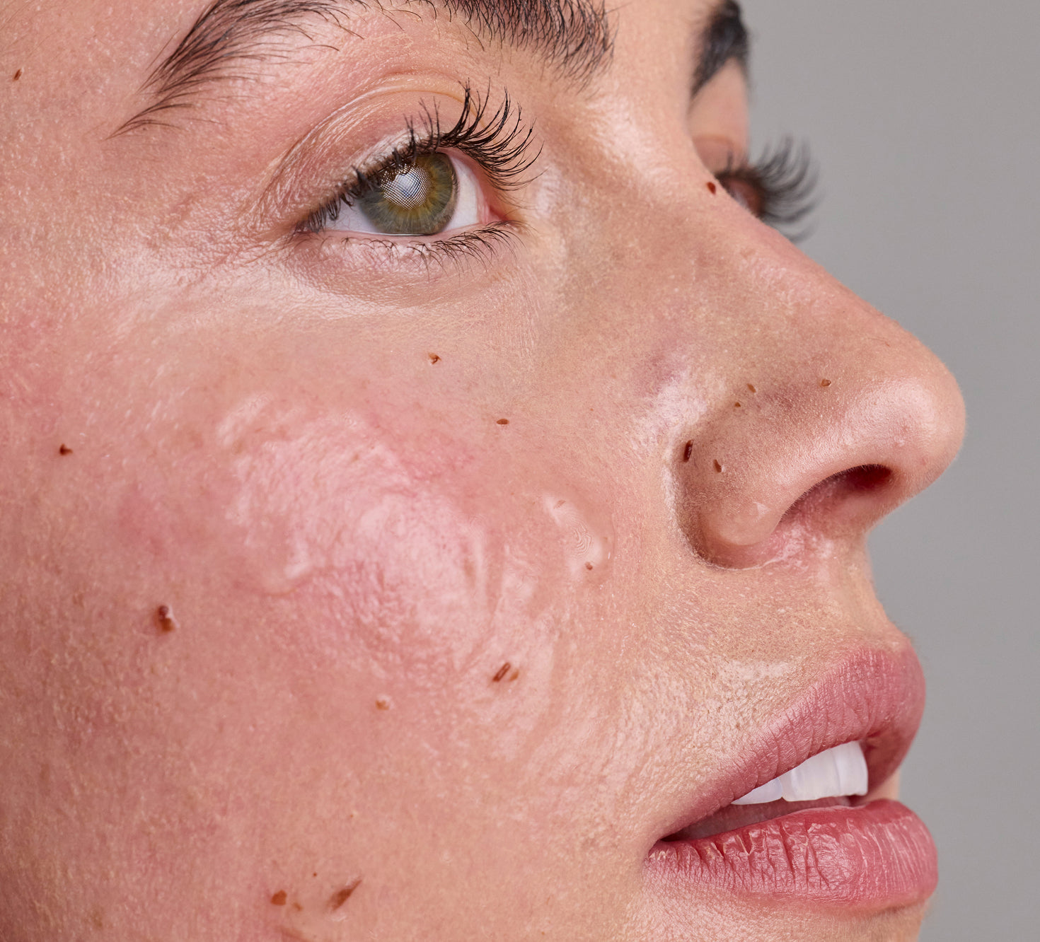 Close-up of a person's face with zombie cell clarifying mask applied to the skin on a gray background