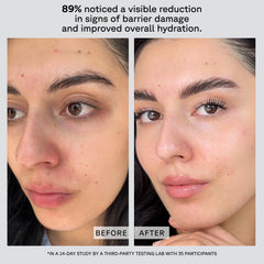 Before and after comparison of a woman's face with text indicating reduced barrier damage and improved hydration.