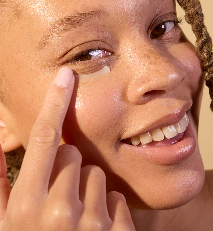 Softened fine lines, after using Acure's Eye balm
